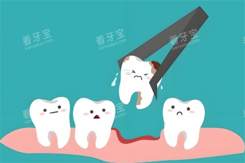 拔牙动画示图 拔牙动画示图