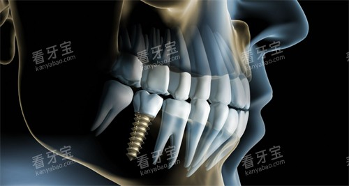 ������ֲ������ʾ��ͼչʾ