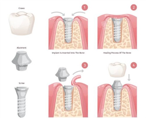 ��ֲ������ͼ