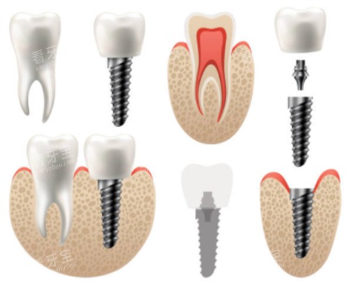 滨州中悦口腔医院正规不?合规经营+患者认可口碑,复杂种植+早矫服务有保障!