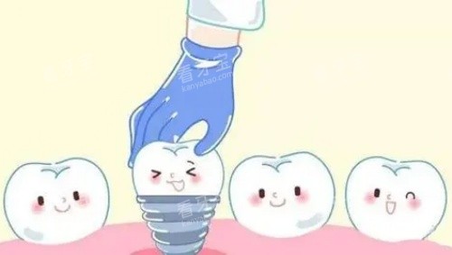 单颗牙齿种植示意图 单颗牙齿种植示意图