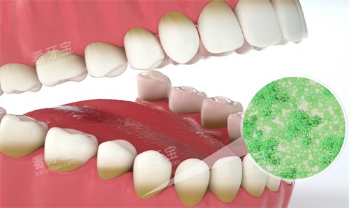 �����ϻ���ڵ�ϸ��