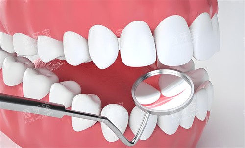 牙齿检查动画展示图 牙齿检查动画展示图