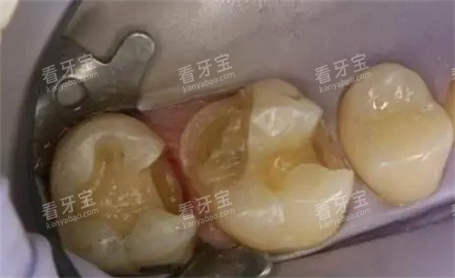 泉州泉口口腔地址位于鲤城区笋江路新天城市广场1号门西侧约30米,直接导航就能找到!