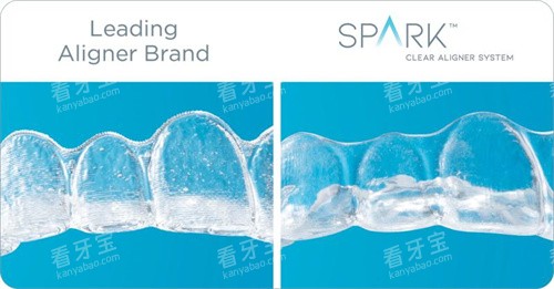 Spark精靓隐形矫正器通透度更高 Spark精靓隐形矫正器通透度更高