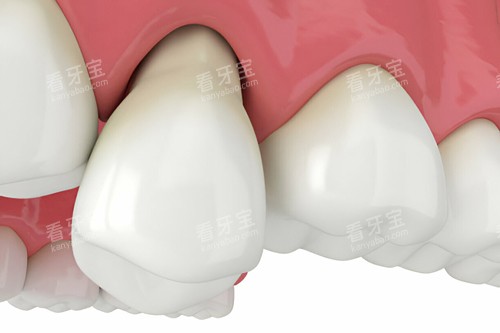 �����ɶ�ģ��ͼ