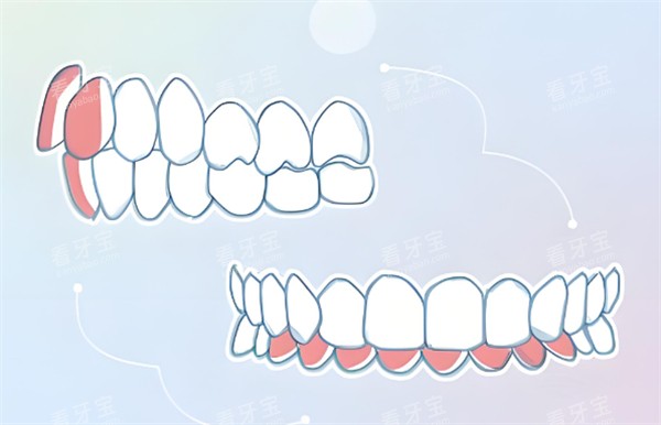 ��ϸ���ǶԱ�ͼʾ