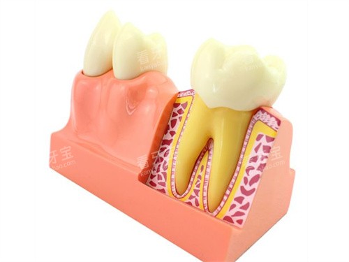 牙齿解剖模型 牙齿解剖模型