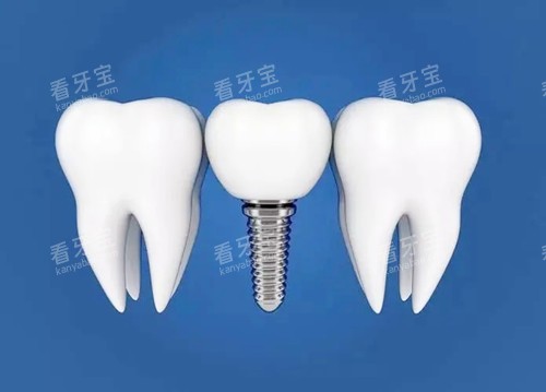 ��ֲ����ͨͼ