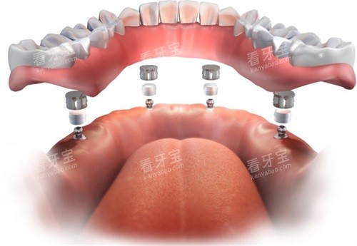 ��ñʽ�����帲����ݼ۸񹹳�ȫ������������+������+��ݷѣ�����������