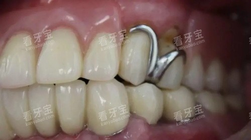 һ�Ķ�����ʲô���޹ҹ����ܸ�������ݣ��ṹ+����+�޸����̷���