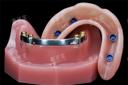 locator��ֲ������ݼ۸������ϵ3����/ŷ��ϵ5��+��ôѡ��