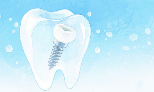 ��ֲ��ʾ��ͼ