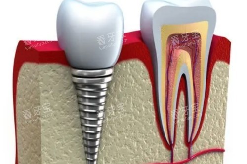 ��ֲ��ֲ��ģ��ͼ