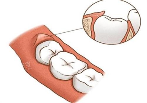 ������ð��ͼ