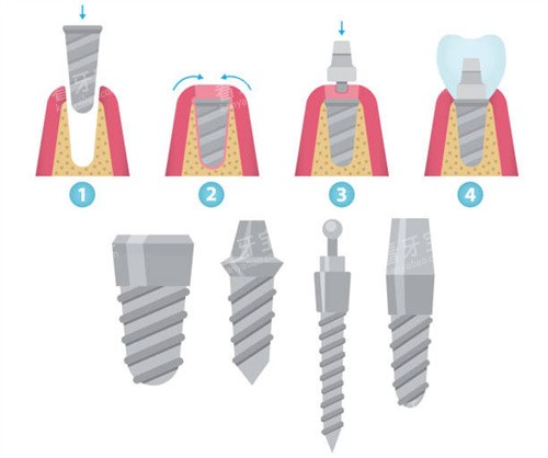 ��ֲ�������ֲ���ͺ�