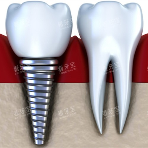 ������ֲ��չʾͼ