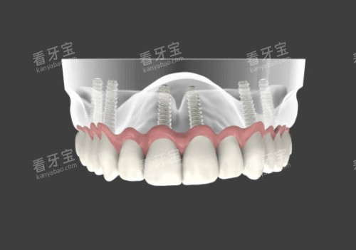 �����ֲ��ģ��ͼ