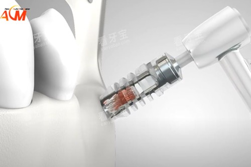 �¹�ACM��ֲ��ʾ��ͼ