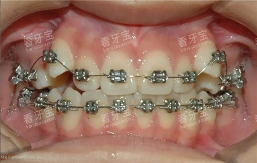 ���ݽ�������ͼ