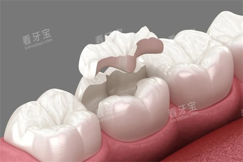 ��λǶ�忨ͨͼ