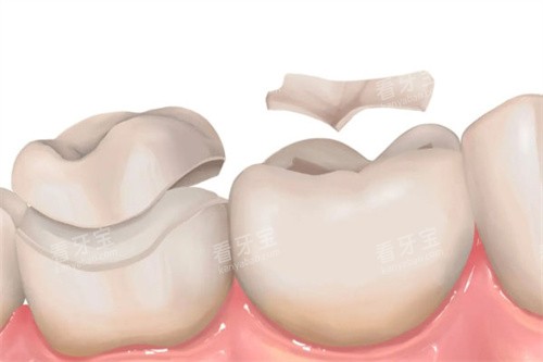 ��λǶ���һ��Ƕ��Ա�