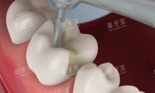 Ƕ�岹������