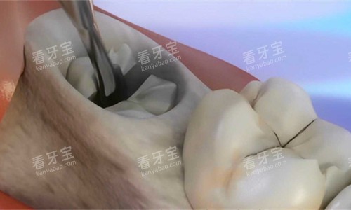 ����ȣ��չʾͼ