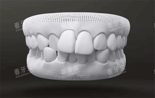 ���ݻ���ͼʾ