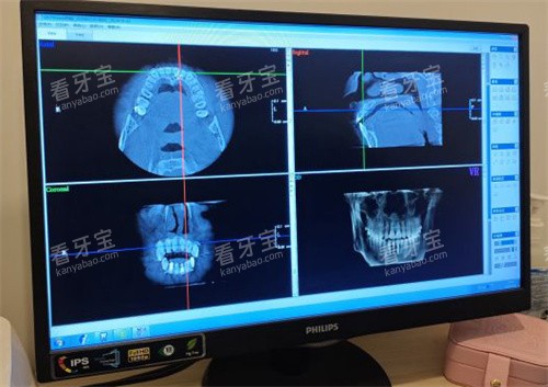 北京雅德嘉口腔牙齿拍片 北京雅德嘉口腔牙齿拍片