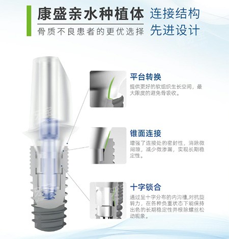 康盛亲水种植牙 康盛亲水种植牙