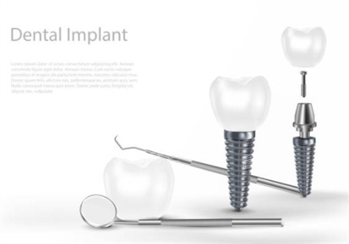 ��ֲ��������ʾ��ͼ