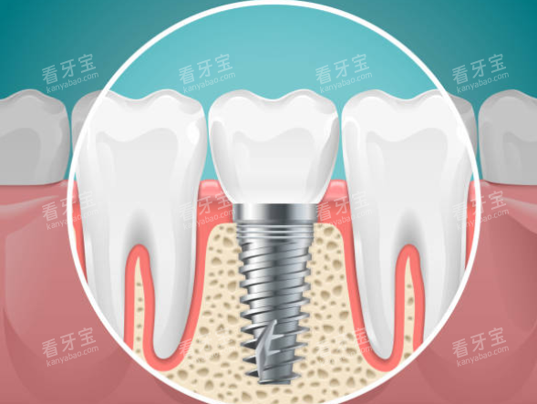 ��ֲ����ͨͼ