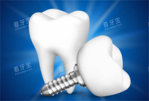 2����ֲ��ģ��ͼ