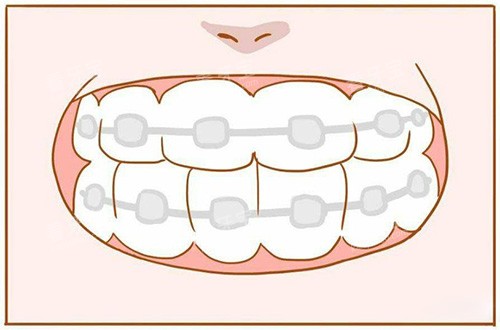 ���ݽ�������չʾͼ