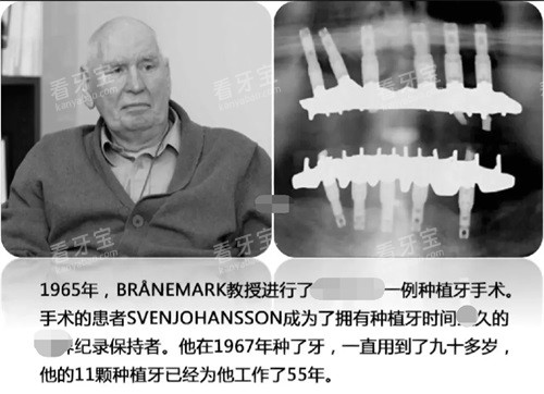 ��ֲ����¼ʾ��ͼ