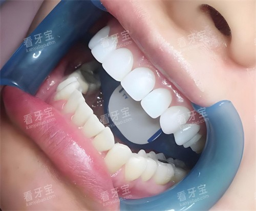 ���������������ļҿ��ף�����ʿ��ǻ������Σ���ʵ���۰���ܿӣ�