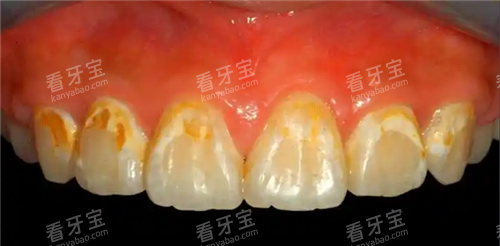 �Ӽ�����ȥ�ļ��ֱ����ֺã����漼����ʵ������ҽԺ�Ƽ�����ݼ۸�͸����ָ�����㲻�ȿӣ�