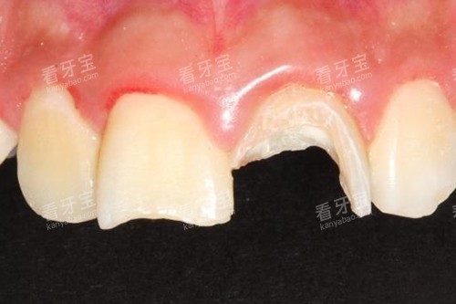 ����ˤ��ʵ��ʾ��ͼ