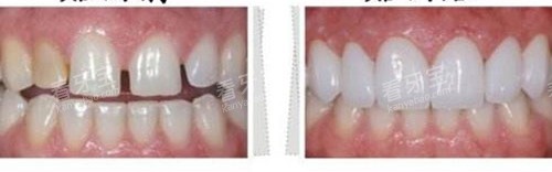 ��������ǰ��ʾ��ͼ