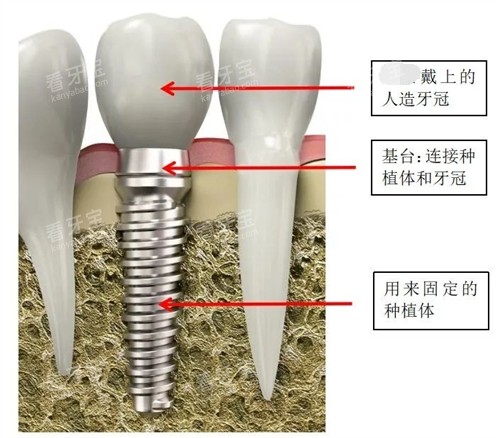 ��ֲ���ṹ��������ͼ