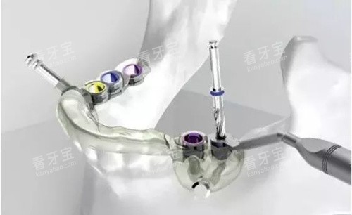 ��ֲ�������������е�Ӧ��