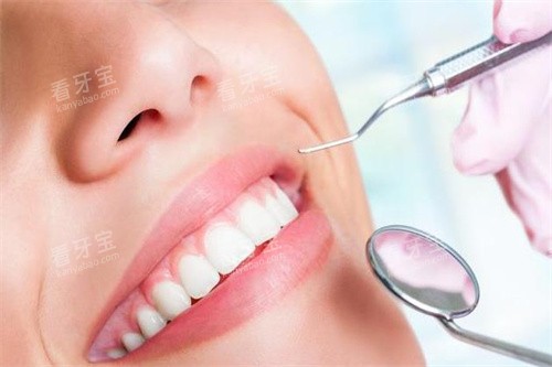 ���ݼ������ͼչʾ