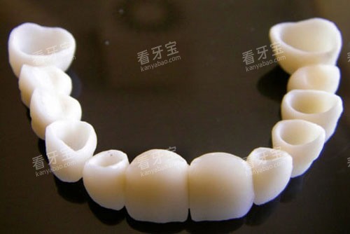 半口全瓷牙冠示意图 半口全瓷牙冠示意图