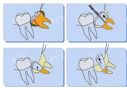 ��ͬ�ǳ�����ʵ����