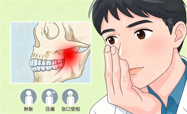牙齿问题 牙齿问题