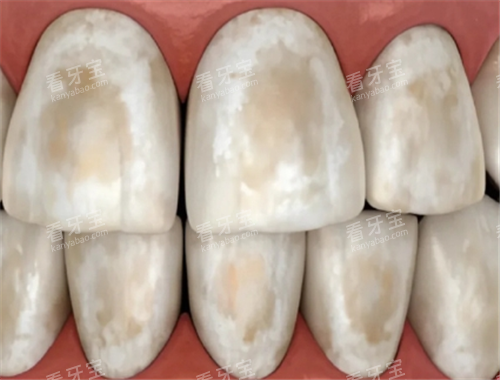 �����ѿ���Ƭ