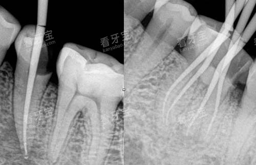 ��Ȫʱ���ǻҽԺ�����շѼ۸��������2026�۸�����£�ϴ��98Ԫ����ֲ��3980Ԫ��