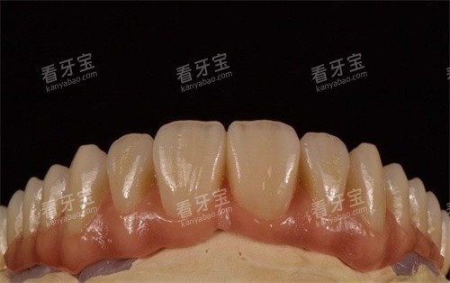 �ػʵ���ǻҽԺ�����۸����ѯ:2026�꿾������680��,��������4000+,��֬����195��/��~