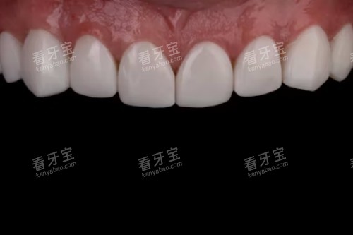 ���ݻ�������ͼ